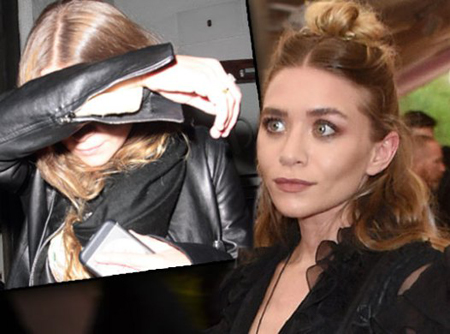 Ashley Olsen reportedly got a bad reaction from chemicals after a facelift.